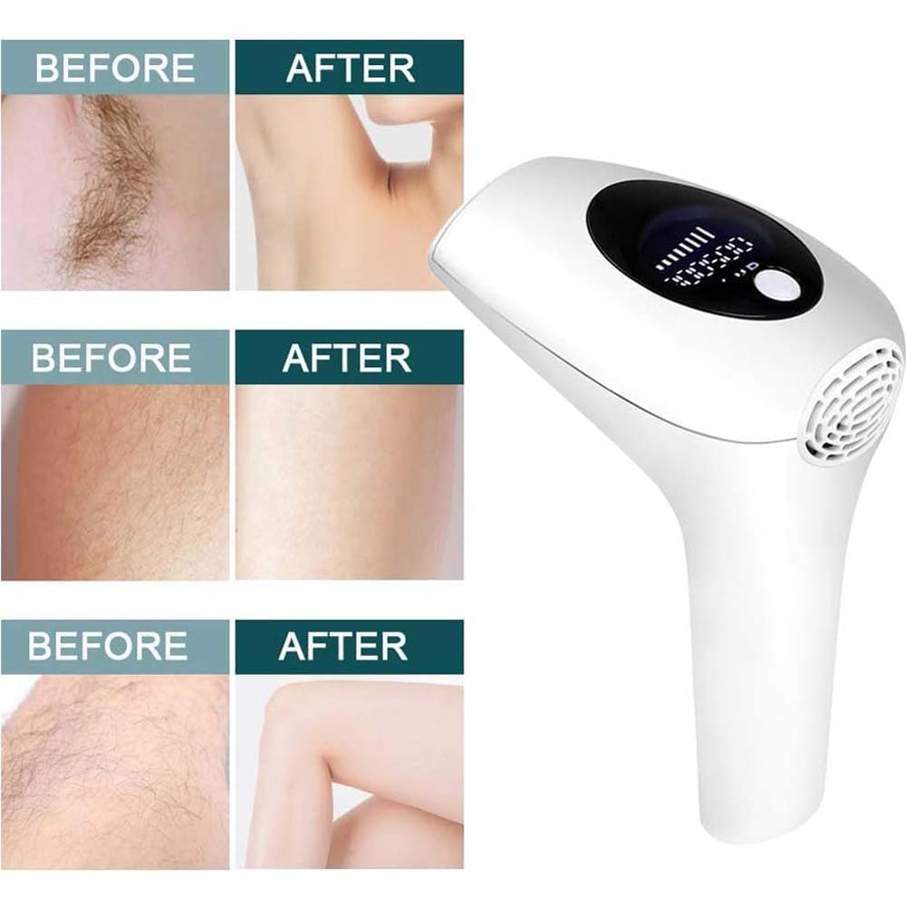 Laser Hair Removal System with 900,000 Flashes. 5 energy settings for face, legs, underarms, bikini & arms. Painless & permanent.