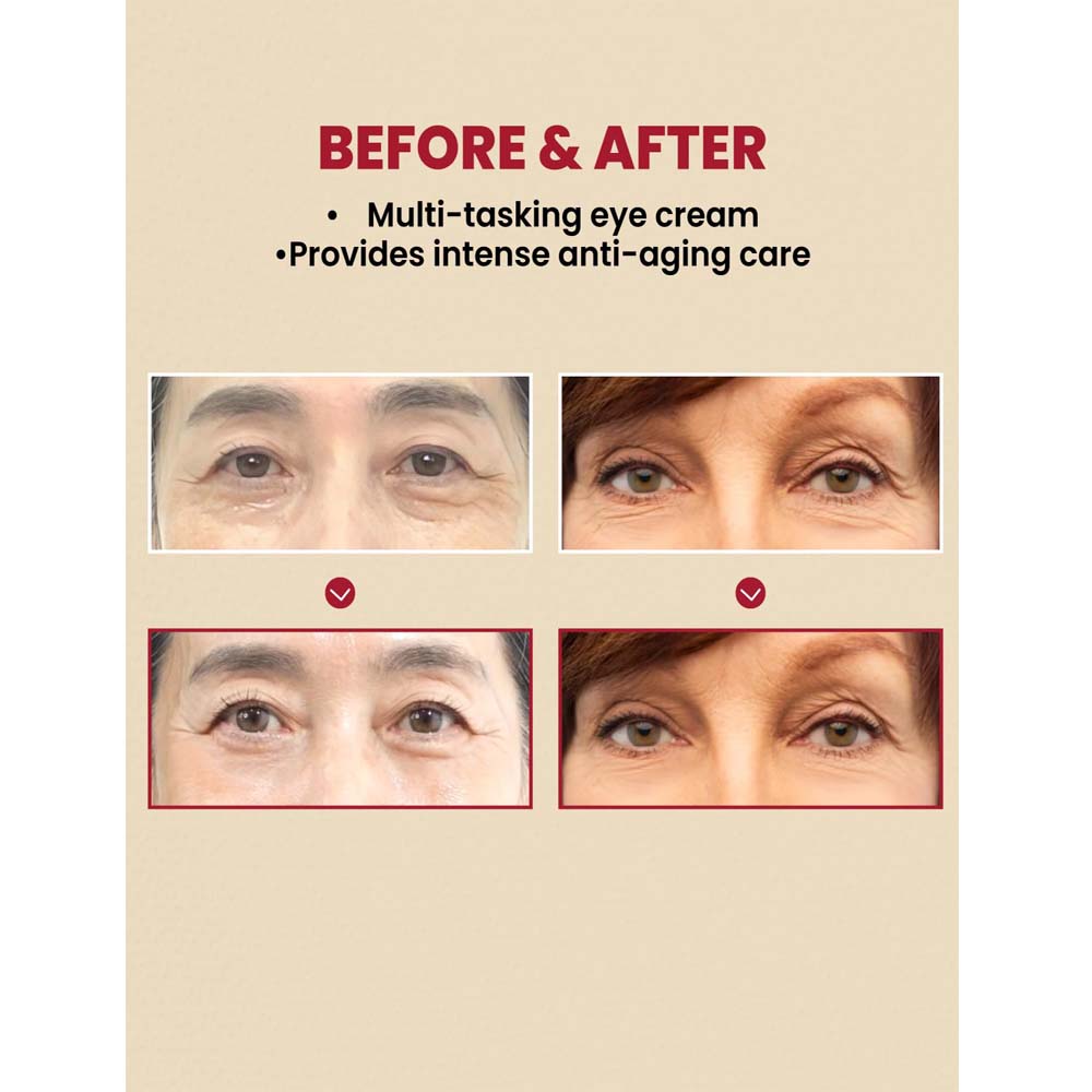 KSECRET SEOUL 1988 Eye Cream – Retinal Liposome 4% + Fermented Bean, Anti-Aging Wrinkle Care, Improves Elasticity & Pigmentation, 30ml / 1.01 fl.oz
